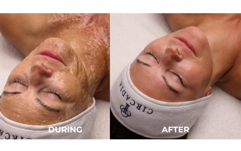 pro aging luxe lift treatment